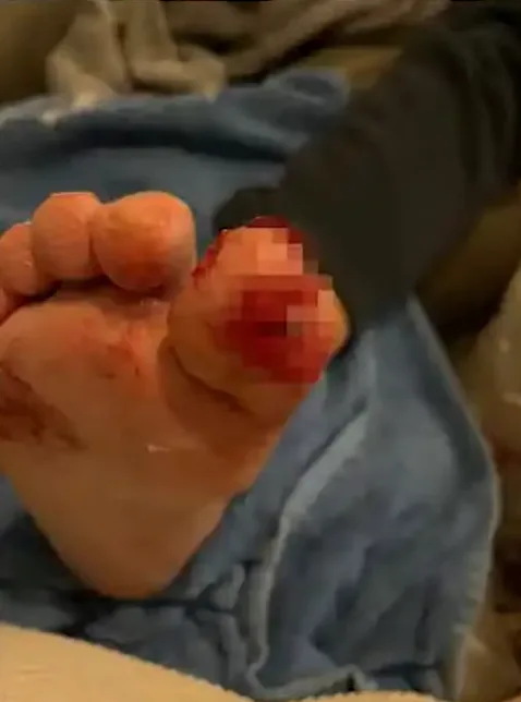 Man Wakes Up With His Toe Chewed ‘To The Bone’ By His Puppy, Hospital Scans Reveal The Unthinkable