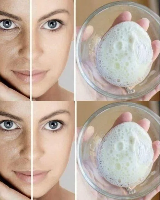 Step-by-Step Guide To Make Baking Soda Cream That Removes Wrinkles Skin Spots And Blackheads