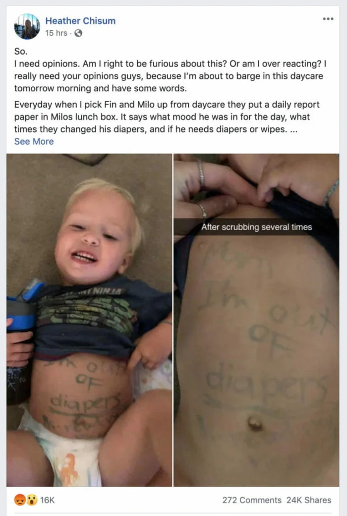 Daycare Worker Fired Over Message She Wrote On Toddler’s Belly