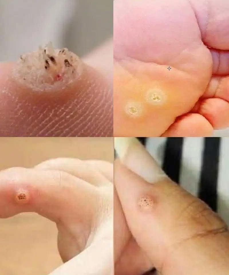 To BE VERY CAREFUL . If you get this, you are infected with …. Check the 1st comment