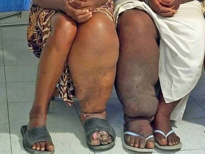 These are the consequences of sleeping with a… See more