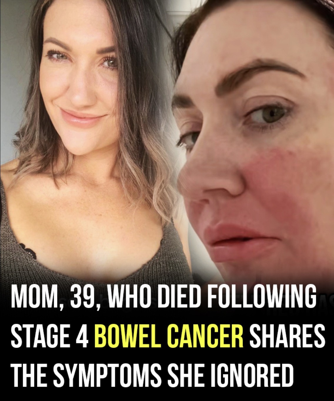 Mom, 39, dies following stage 4 bowel cancer: Here’s the symtom she ignored