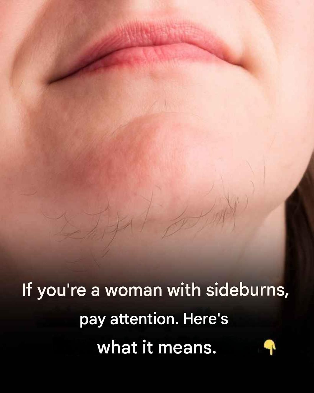 What your chin whiskers might tell you about your health