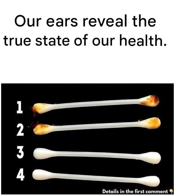 Our ears reveal the true state of our health.