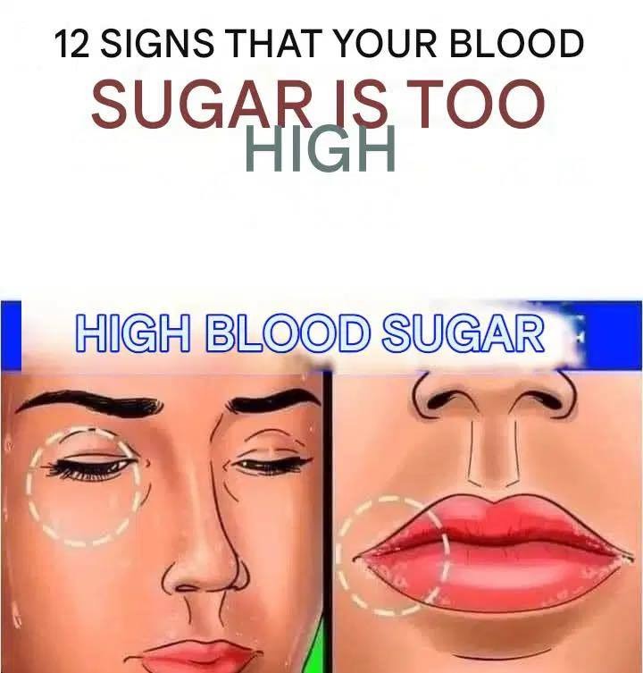 12 Signs Your Blood Sugar is Too High