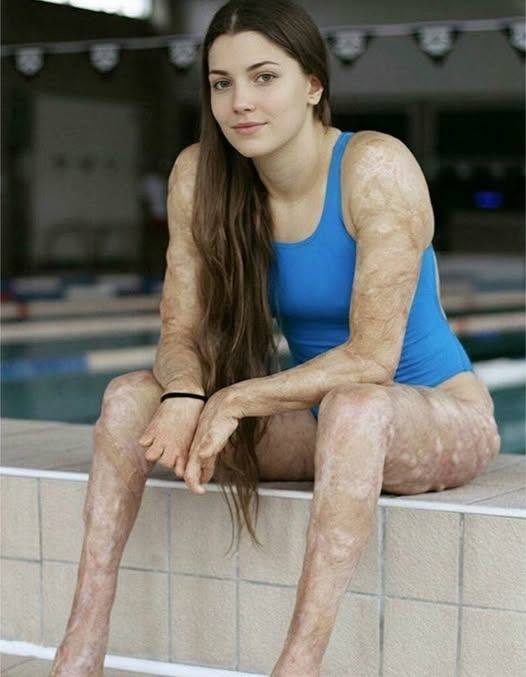 These are the consequences of sleeping with the…