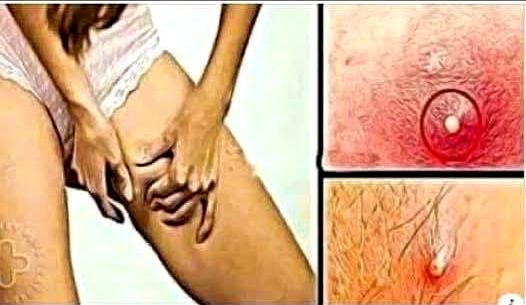 These are the signs that he is cr… See more