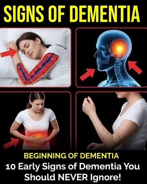 10 Signs of Dementia You Should Never Ignore